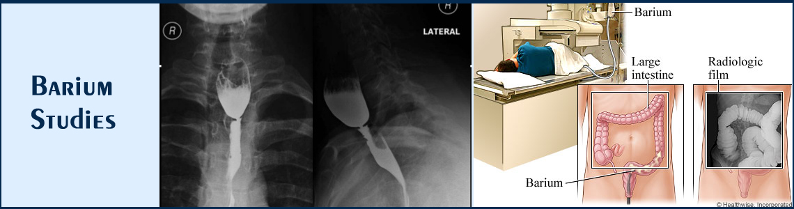 Barium Studies